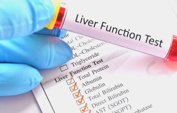 Liver Function Tests